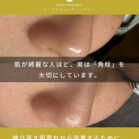 ブログ